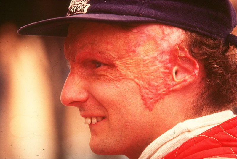 Illustration for article titled The Fiery Crash That Nearly Killed F1's Niki Lauda Happened 40 Years Ago Today
